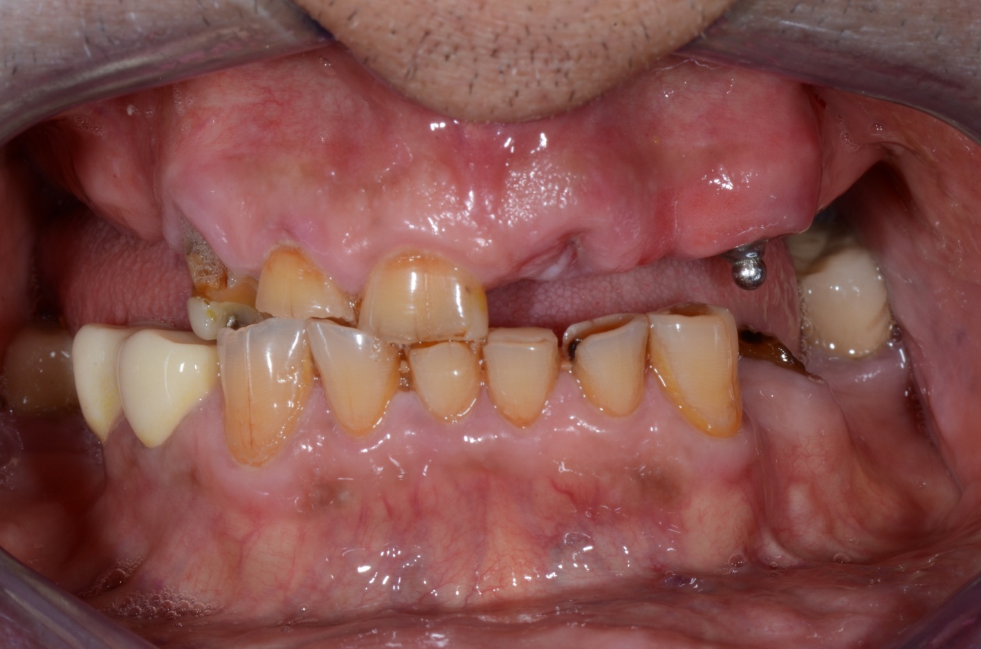 hopeless-teeth-finished